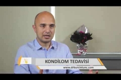 Kondilom Tedavisi